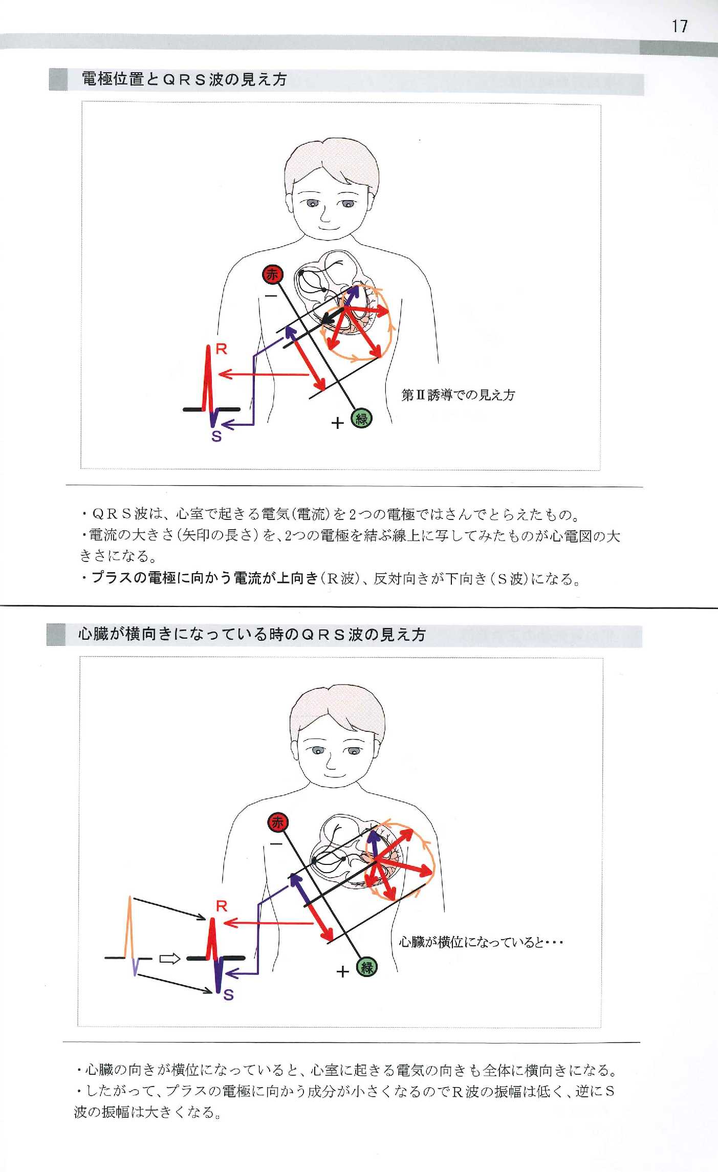 基礎不整脈