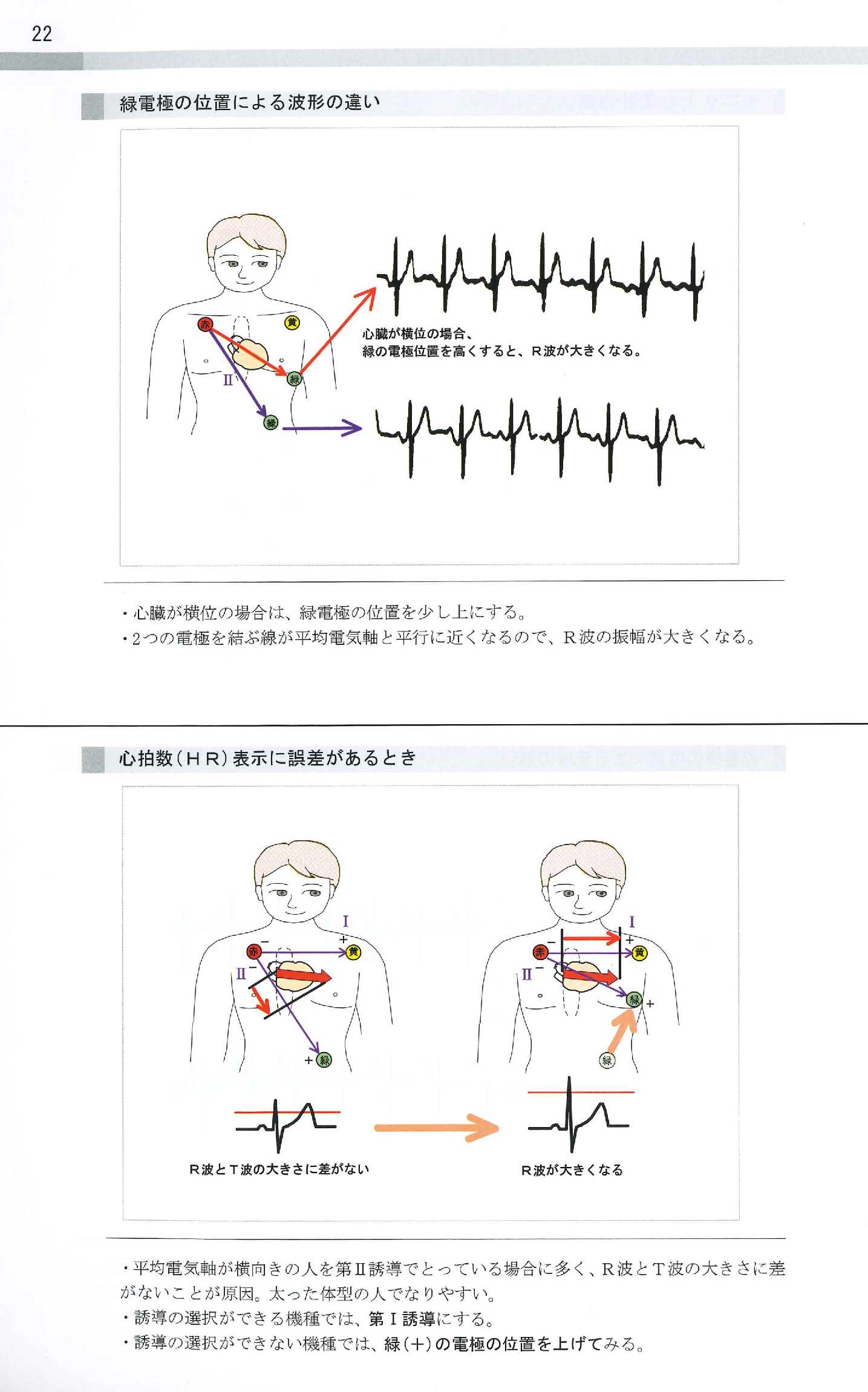 基礎不整脈