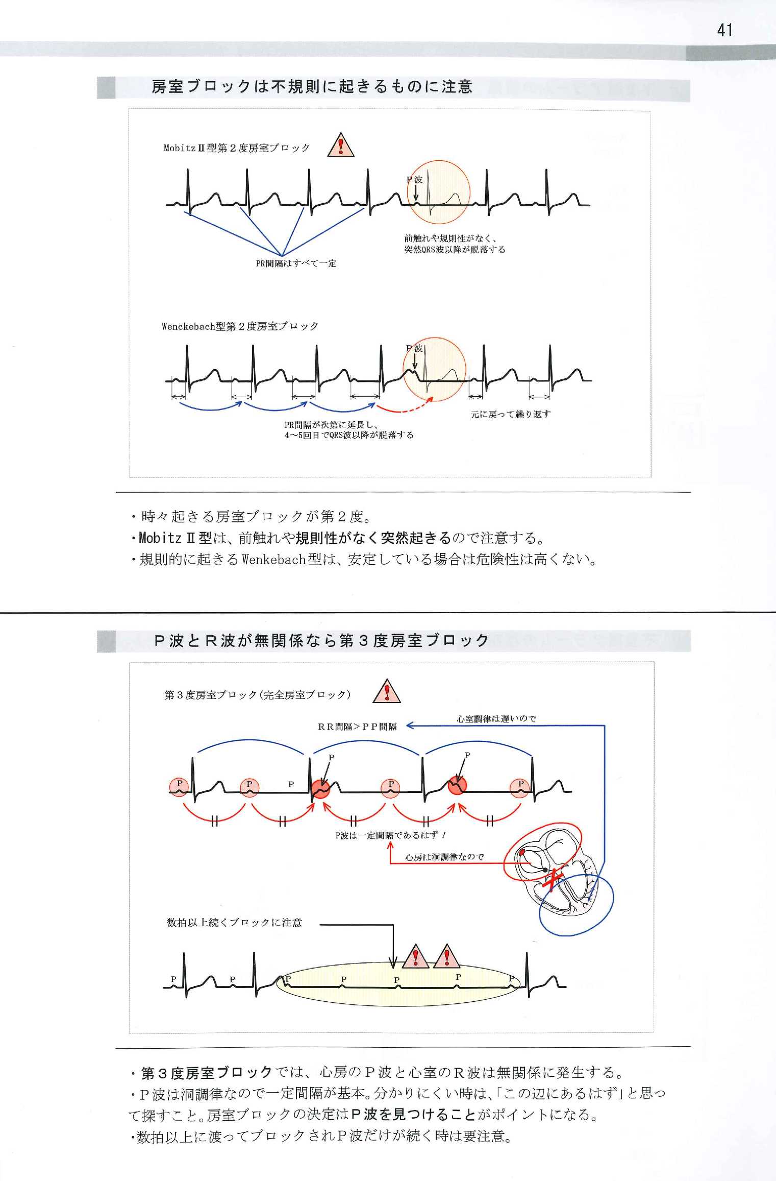 基礎不整脈