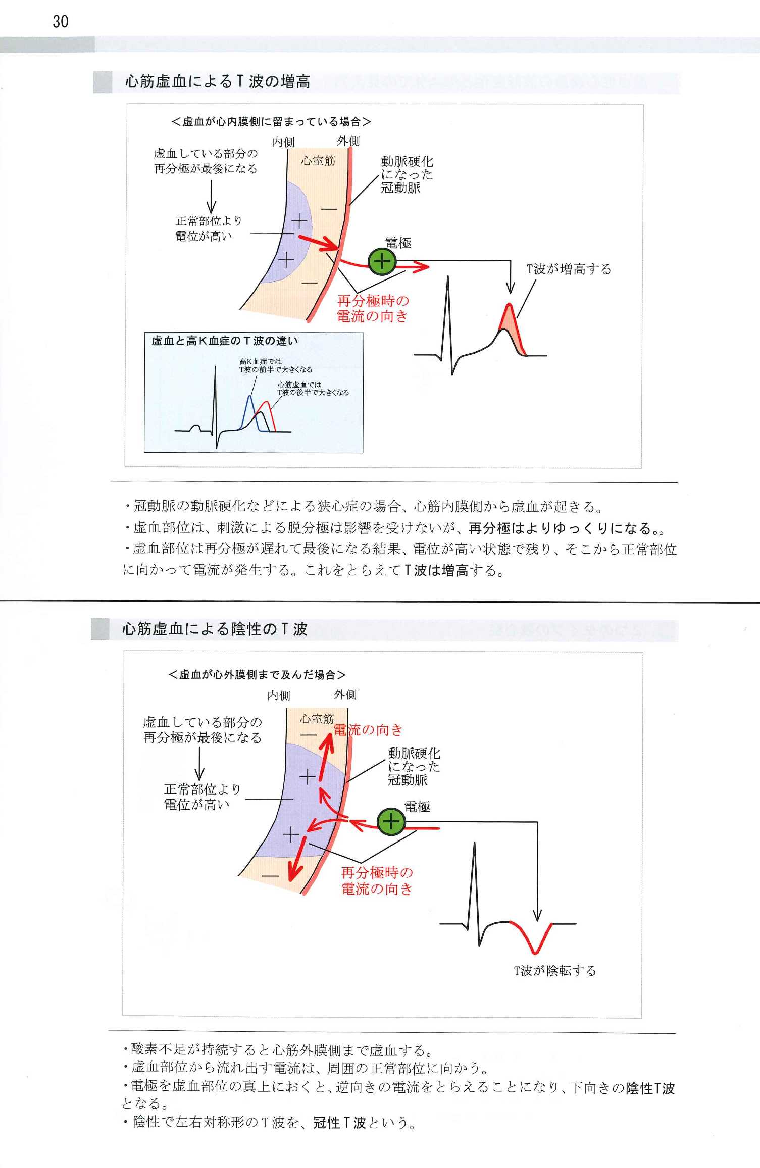 虚血電解質